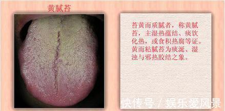 盗汗|儿科主任:夏季孩子脾虚积食多,少吃“2红”,多吃“2黄”