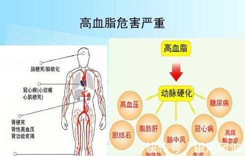 低密度脂蛋白|血脂降到正常范围以后，还用继续吃药吗？