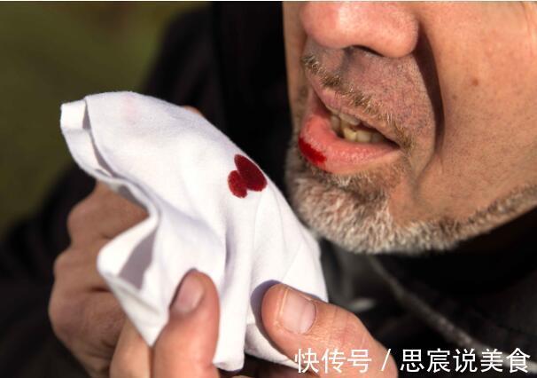 症状表现|癌症靠近时,细心的人会发现四处“破绽”,你还不知道吗