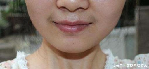为什么有些女生的嘴唇上会长“胡子”?教你两招,轻松去除掉