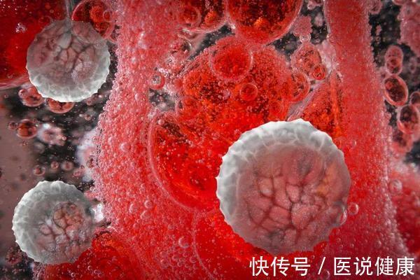 出血|血液病发病前,身体或出现这5个异常表现,发现后,需及时就医