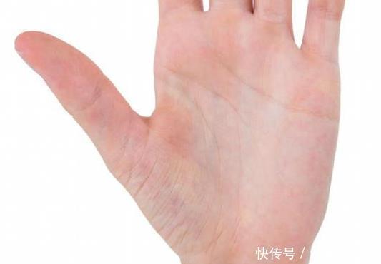  身体|肝癌早期不疼不痒，若是手掌出现这个“信号”，预示体内有癌细胞