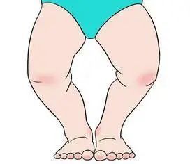 宝宝|【科普】维生素D该如何给宝宝补？