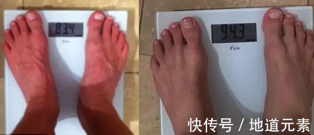 减肥方法|真人实测:一天狂瘦20斤!这个丧心病狂的男人,终于把自己玩坏了