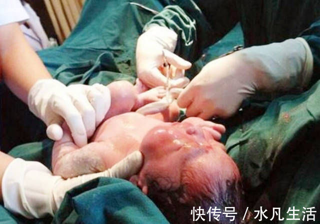 宝宝|宝宝出生就有牙齿?妈妈炫耀孩子发育早,医生却直言道:高兴太早