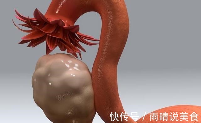 宫颈癌|32岁女子查出宫颈癌,自称没有任何疼痛感,但是2个指标要重视