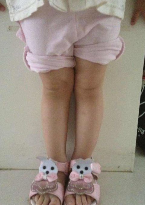 孩子|孩子腿部有这3个特征,长大多半是“大长腿”