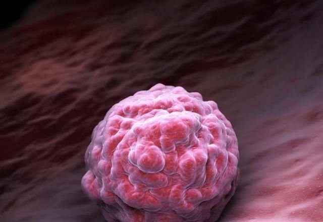 爸妈|怀孕50天做孕检，医生告知是“空孕囊”，准爸妈都要当心了！