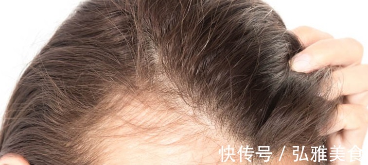 肝气不舒|一个大气磅礴的妙方，血府逐瘀丸，学会妙用，横扫全身各种疾病！