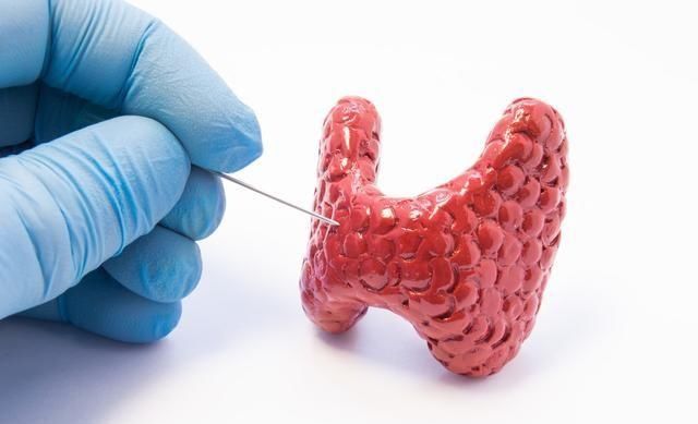 甲状腺结节等于甲状腺癌吗？得了甲状腺结节怎么办？