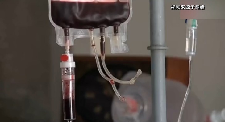 输血者|直系亲属之间能输血吗?医生:这种情况下不建议