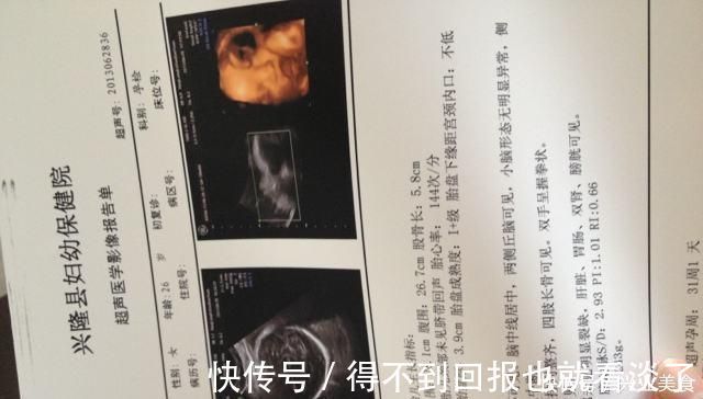 四维彩超|孕期,做“四维彩超”时能看出宝宝性别或许聪明孕妈都能看明白