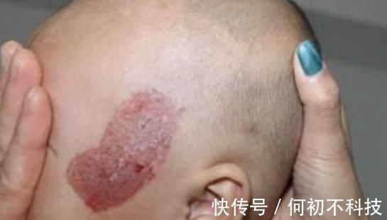 怀孕|女性怀孕后,几件事孕妇最好不要干,要不然出生的婴儿可能有胎记