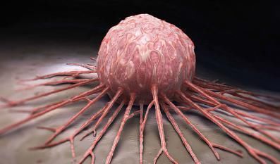 烧烤|世界卫生组织公认的最强致癌物，卖相难看，很多家庭却舍不得扔