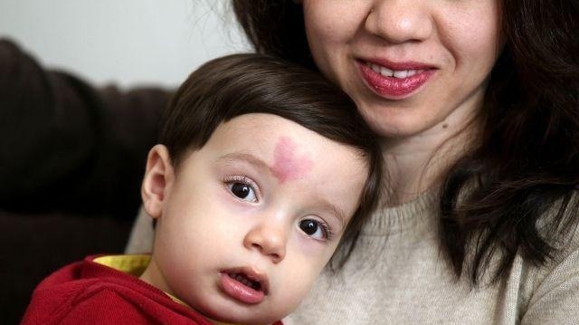 宝宝|宝宝的胎记怎么来的?产科医生:孕期这2种行为易长胎记,要避开