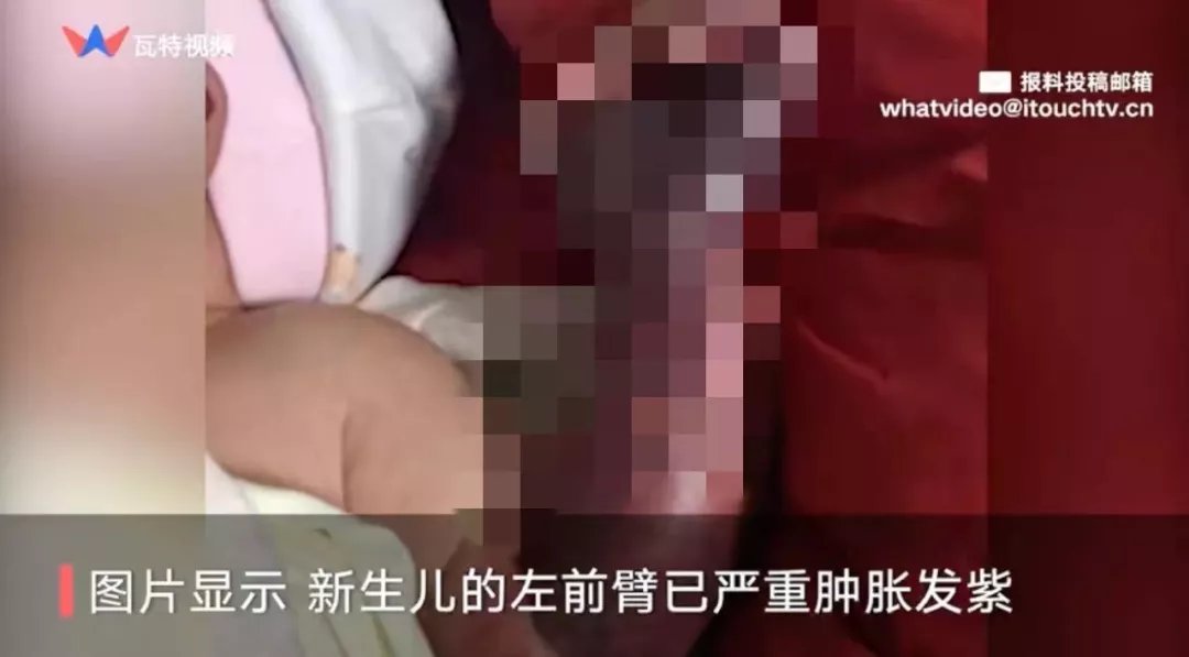 橡皮筋|触目惊心！刚出生1天的宝宝险被截肢，只因妈妈一个疏忽…