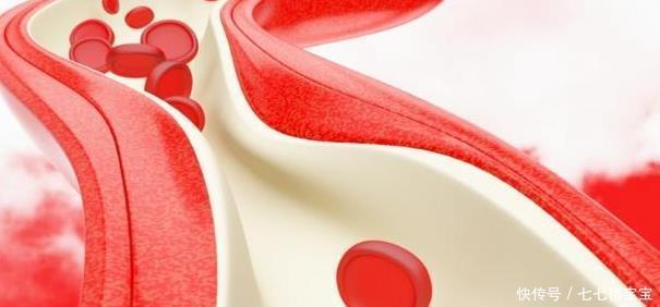 表现|无论男女,若身体有5种“表现”,说明可能有血栓已形成!