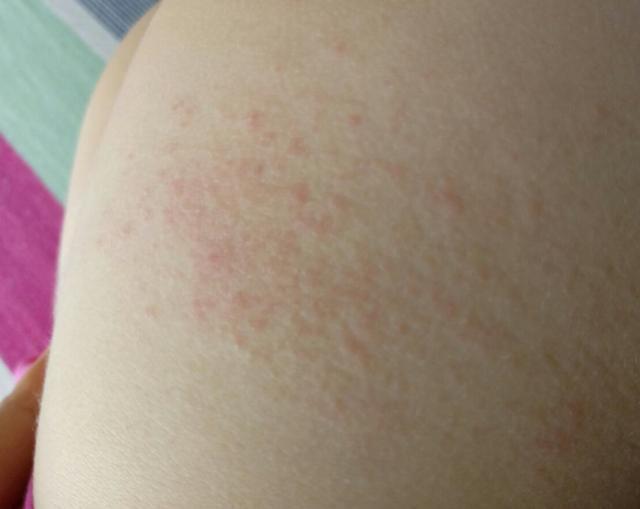 清洗|宝宝拉完“臭臭”之后,应该选择温水清洗还是用纸巾擦学问很多