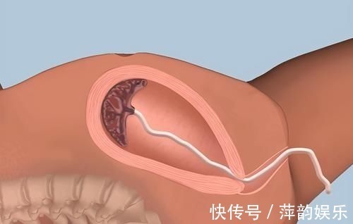 产后|分娩结束后,男医生又把手伸进产妇肚子里,别急骂医生是为了你好