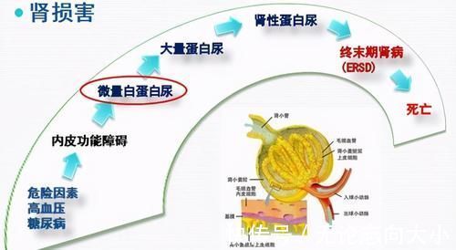 检查|高血压3年没治，就造成了心肾损害？发现高血压都该查些什么？