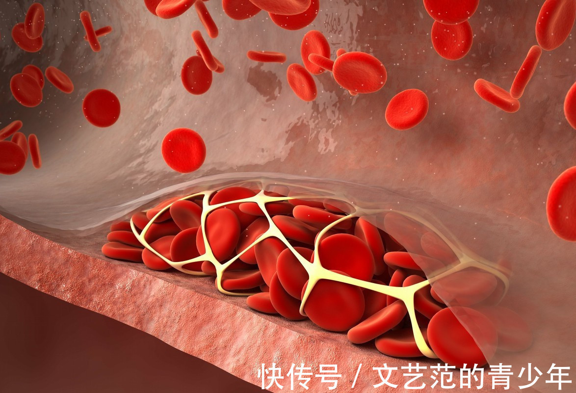 预防心血管疾病|天然的“溶栓剂”出现了,经常吃可帮助稀释血液,或许能避免脑梗