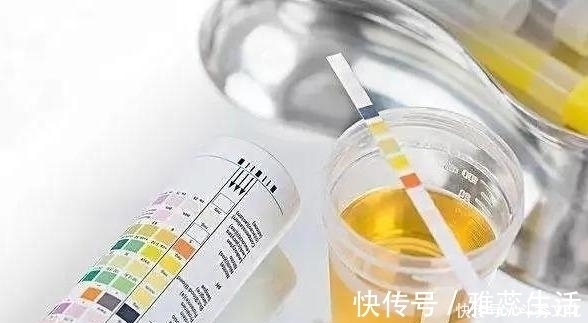 糖尿病人|糖尿病人尿中有泡沫,两个+专家谈治疗方案