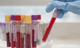 低密度脂蛋白胆固醇高和饮食相关,管住嘴就行医生辟谣讲清楚