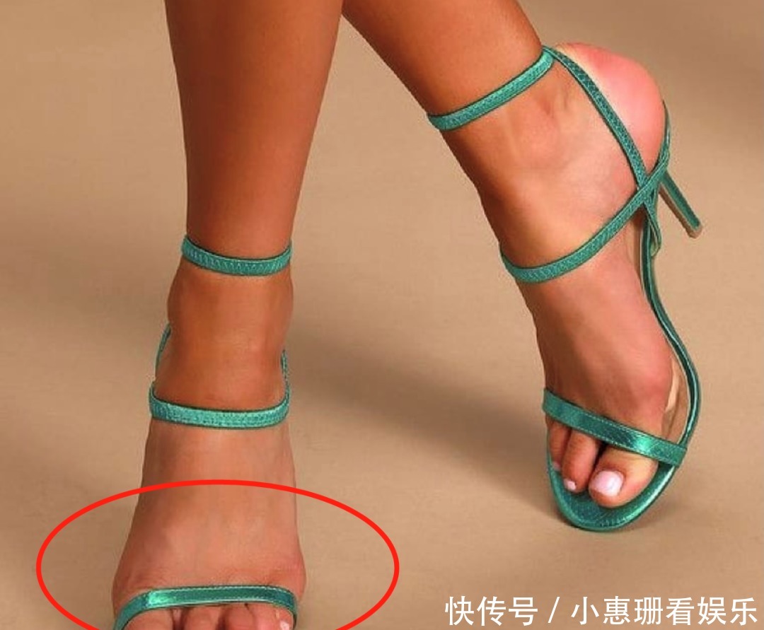 脚背|凉鞋该换了!我劝你穿这4双,太好看了