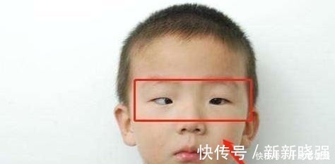 医生|5岁男孩沉迷玩手机,黑眼珠逐渐“消失”,医生这孩子废了