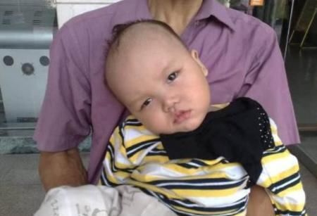 补锌|孩子身体有这4个信号,说明宝宝“缺锌”,会影响孩子生长发育