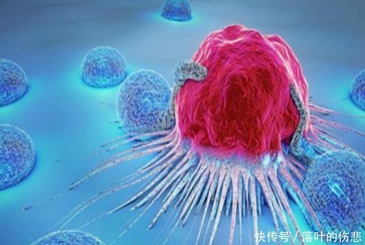 疾病|“癌症”是西方的叫法,在我国古代,中医们叫它什么