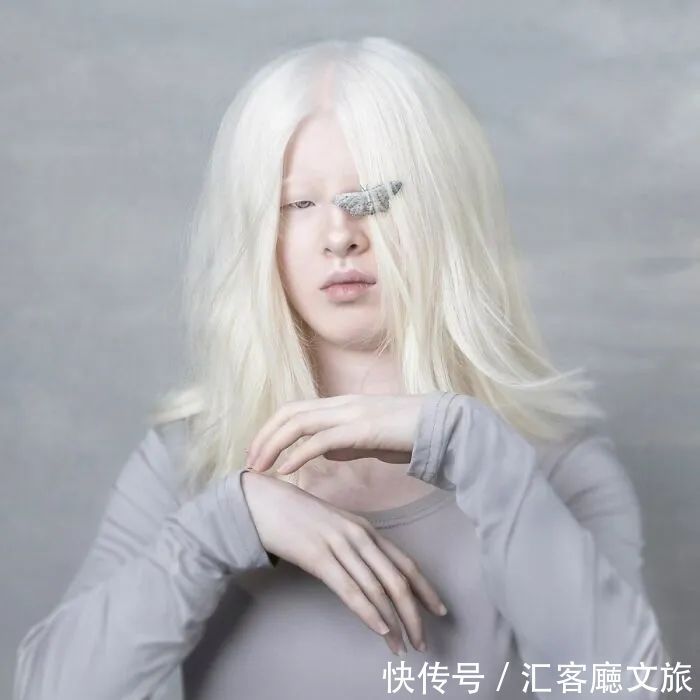 逆袭|因“全身雪白”被遗弃的中国女孩,逆袭成超模的故事让人泪目