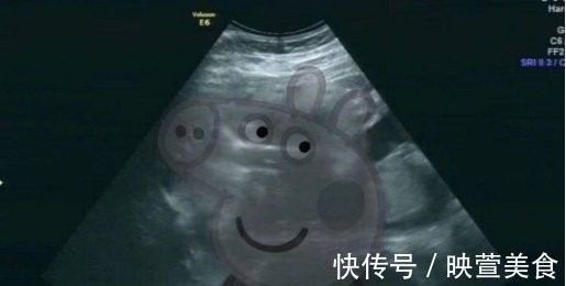 b超检查|孕24周B超检查,当看到宝宝的样子后,孕妈有些吓到了