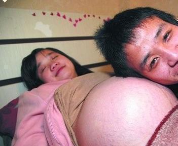 四胞胎|怀孕2个月肚子大的走不动,检查后全家人既欢喜又忧愁