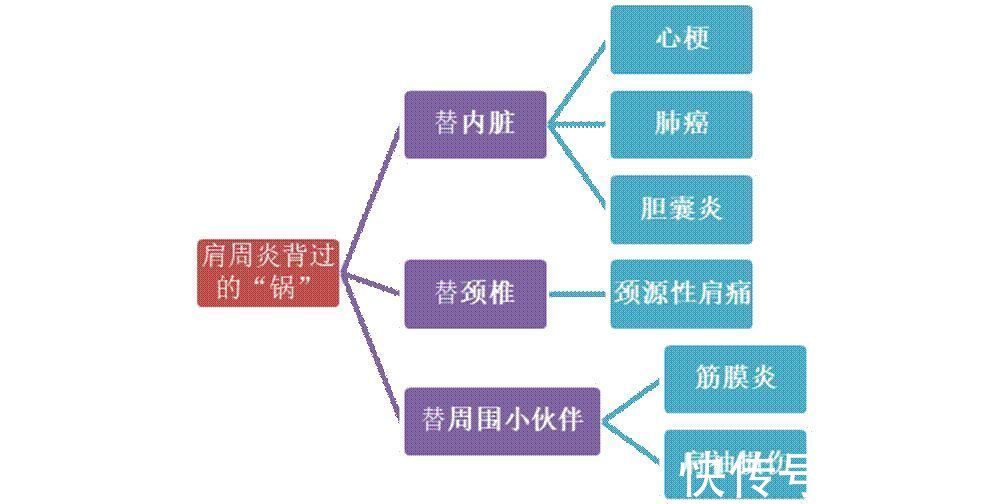 颈椎|小心！肩膀疼，不一定是肩周炎！背后隐藏数十种疾病！误诊误治，后果很严重