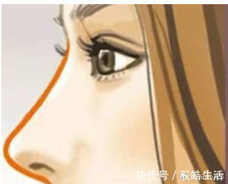 内需|隆鼻手术到底会不会留疤痕?疤痕体质能做鼻整形手术吗?