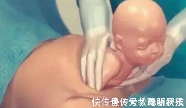 孕妈|剖腹产只是“挨一刀”就完事看完手术全过程,忍不住心疼女人