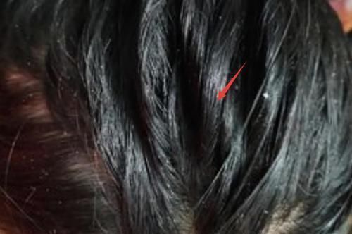头发|头发应该多长时间洗一次别再傻了,难怪你的头发掉得这么快