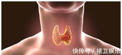 甲状腺结节|甲状腺结节患者的“饮食禁忌”,看完后,不妨收藏