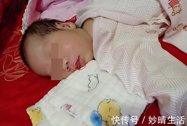 女婴|五个月女婴双肾长满结石,只因刚出生三天,父母就开始做这件事