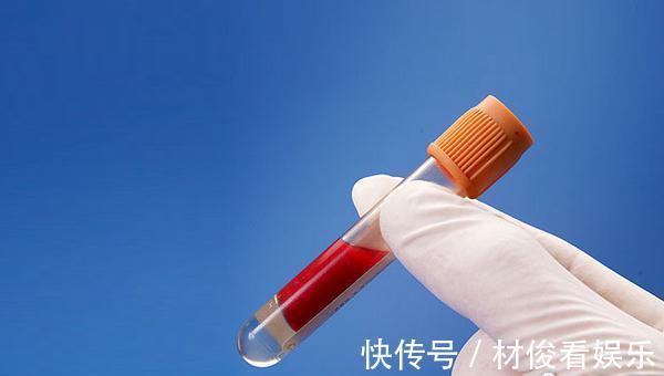 医生|得了高血脂怎么办医生强调别担心,常吃5种食物血脂会更安全