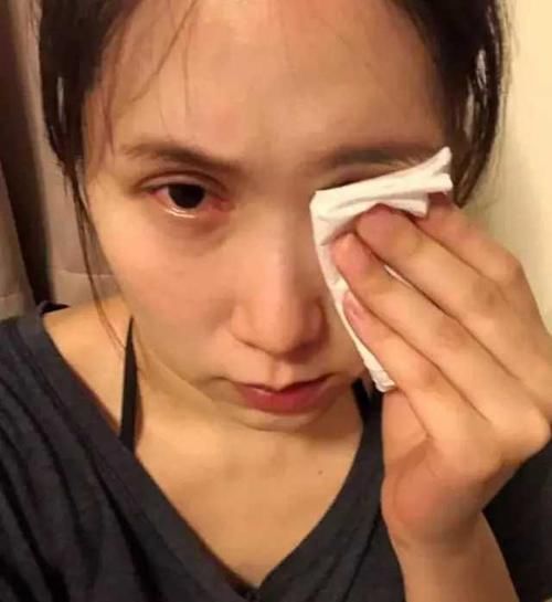 大肠癌|琪琪时隔7年大肠癌再复发！医生直言束手无策，此前已化疗50余次