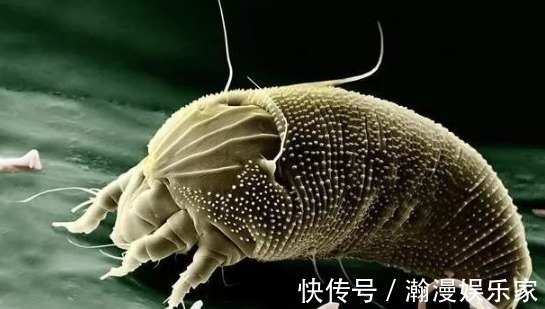 奥地利|螨虫堵塞背后毛孔时,会出现4个明显特征!来学3招除螨