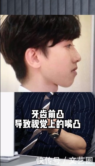 蔡徐坤被质疑整容,男网红回应:他只动了牙齿和下巴,其它地方没喷的