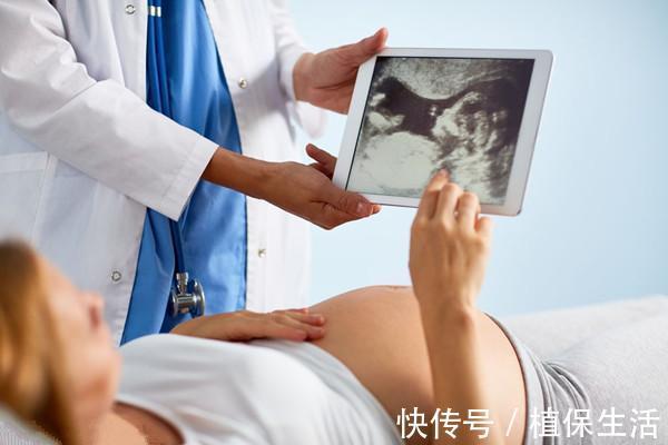 褪黑素|孕妈经常“晚点”睡觉=虐待胎宝,危害往往从孕28周后开始显现