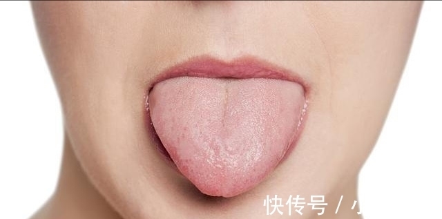 槲皮素|高血压“病因”找到了,医生:一旦出现5种“异常”,警惕脑梗!