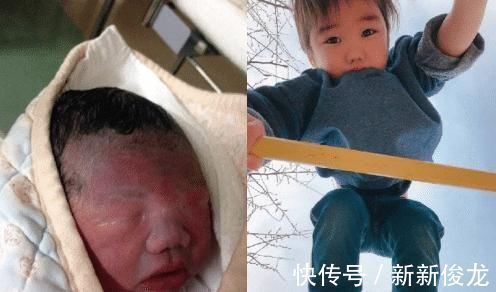 新生儿|新生儿像“小老头”?别失望,日本父母亲身证明“娃大十八变”!