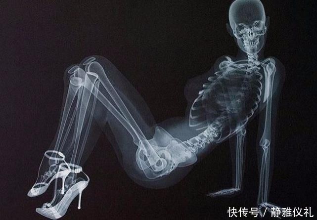 摄影 X光的世界到底长什么样杰克逊太空舞步,接吻让人哭笑不得