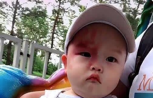 胎记|宝宝的胎记怎么来的?产科医生:孕期这2种行为易长胎记,要避开