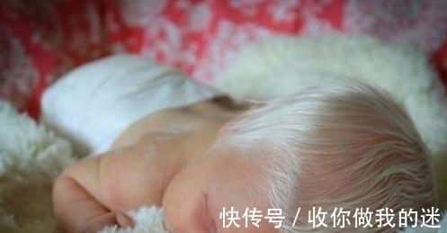 夫妻两人|婴儿生下就满头白发,父母差点将其丢弃,检查结果出人意外